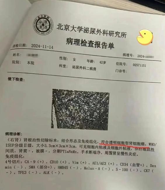 爱康国宾否认漏检、误诊，当事人回应：「不要脸」