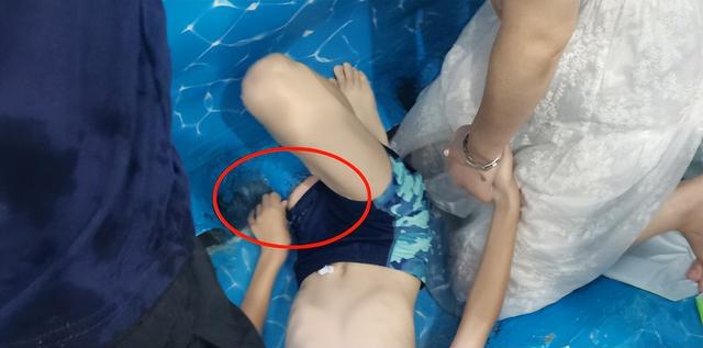 男孩整条左腿被泳池死死“咬住”，紧急提醒：不要靠近